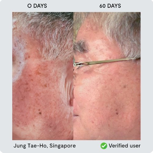 Transformation 3 - Jung Tae Ho