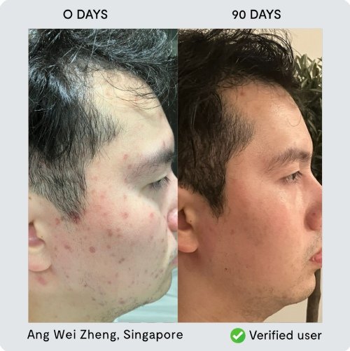 Transformation 7 - Ang Wei