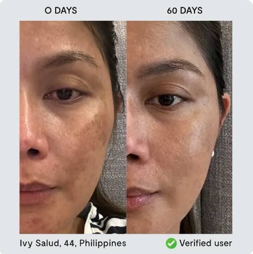 Transformation 4 - Ivy Salud