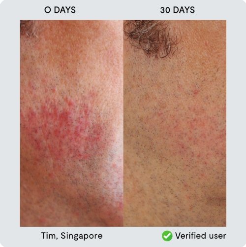 nor sken transformation Tim